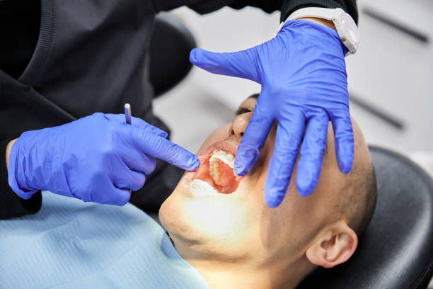 Best Emergency Dental Care for Broken or Chipped Teeth in Paris, TN